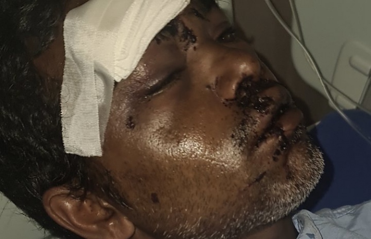 ކޮޗިންގައި ހިނގި އެކްސިޑެންޓުގައި ދިވެއްސަކަށް އަނިޔާ