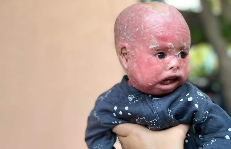 ހަމުގެ ސީރިއަސް ބަލީގައި ލަޔަކް ނިޔާވެއްޖެ