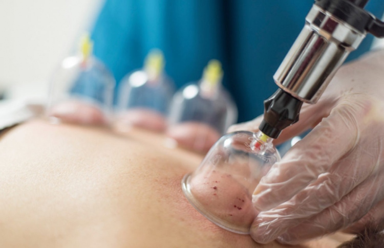 މިންގަނޑަށް ފެތޭ ނަމަ ހިޖާމާއަށް ހުއްދަދެވޭނެ: ހެލްތު