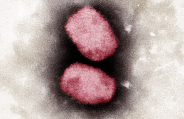 އެމްޕޮކްސްގެ ނުރައްކަލާ މެދު ގޮތެއް ނިންމަނީ