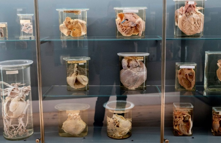 18 ވަނަ ގަރުނުގެ ހަށިގަނޑުތަކެއް މިއުޒިއަމަކުން