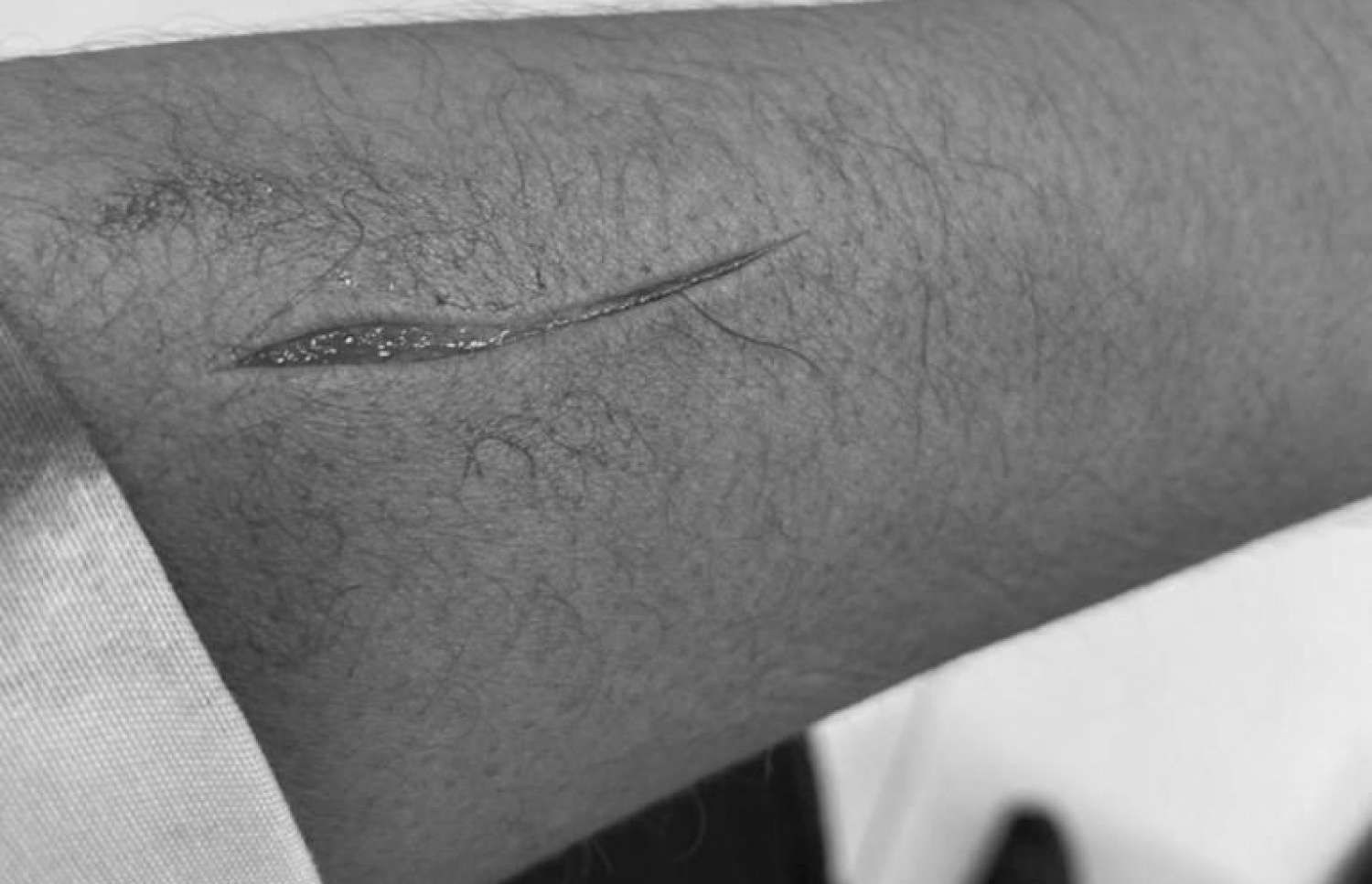 އަލީ ސޯލިހުގެ އަތަށް ހަމަލަދީ މިއަދު ޒަހަމްކޮށްލާފައި.