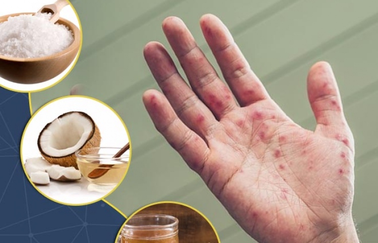 ހޭންޑް ފުޓް އެންޑް މައުތު: އިސްކުރަންވީ ތާހިރުކަން