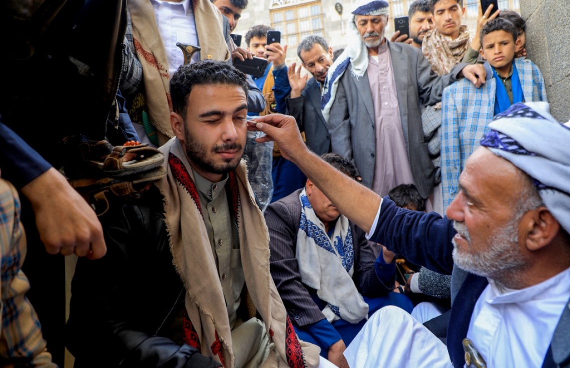 މީހެއްގެ ލޮލުގައި އަނދުން އަޅަނީ.-- ފޮޓޯ: އޭއެފްޕީ