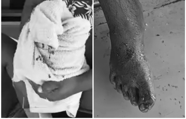 ކަންނެލި ދޯންޏަކުން ވެއްޓުނު މީހަކަށް މިޔަރު ހަމަލާދީފި