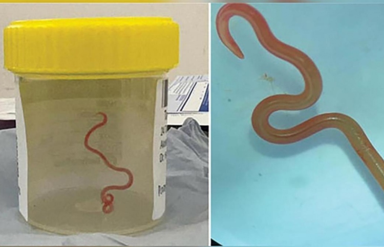 އޮސްޓްރޭލިޔާ އަންހެނެއްގެ ސިކުނޑީގައި ދިރޭ ފަންޏެއް