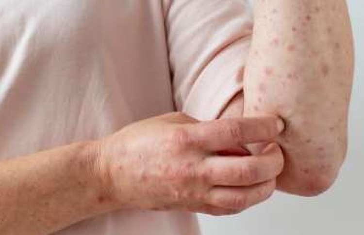 ފާނަބަސަންދު ފެތުރެނީ، މި މަހުގެ މިހާތަނަށް 215ކޭސް