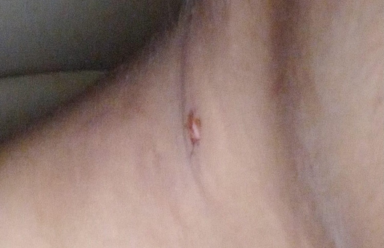 އާއިލާއިން މީހަކަށް އަނިޔާކުރާ ކަމަށްބުނާ މައްސަލައެއް