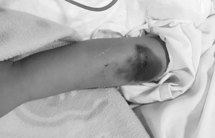 8 މަހުގެ ކުއްޖެއްގެ ހާލު ގޯސްވި މައްސަލަ ބަލަނީ