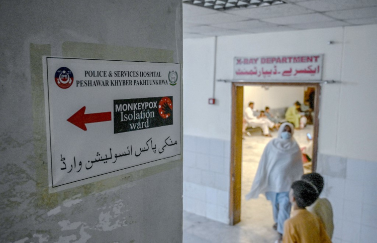 "އެމްޕޮކްސް ފެތުރޭ ބޮޑު ސަބަބަކީ ގައިގައި ބީހުން"