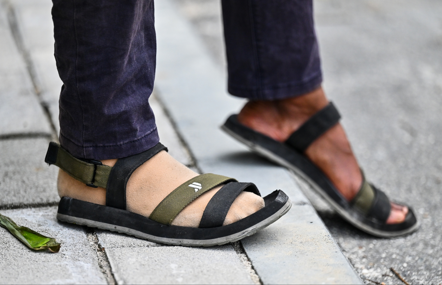 މުހައްމަދު ފިރުޝާންގެ ފައި: ކަނާތު ފައި ބުރިކޮށްލަން ޖެހުމުން އޭނާ ހުންނަނީ މަސްނޫއީ ފަޔެއް ލައްވައިފައި.-- ފޮޓޯ: ފަޔާޒް މޫސާ | މިހާރު