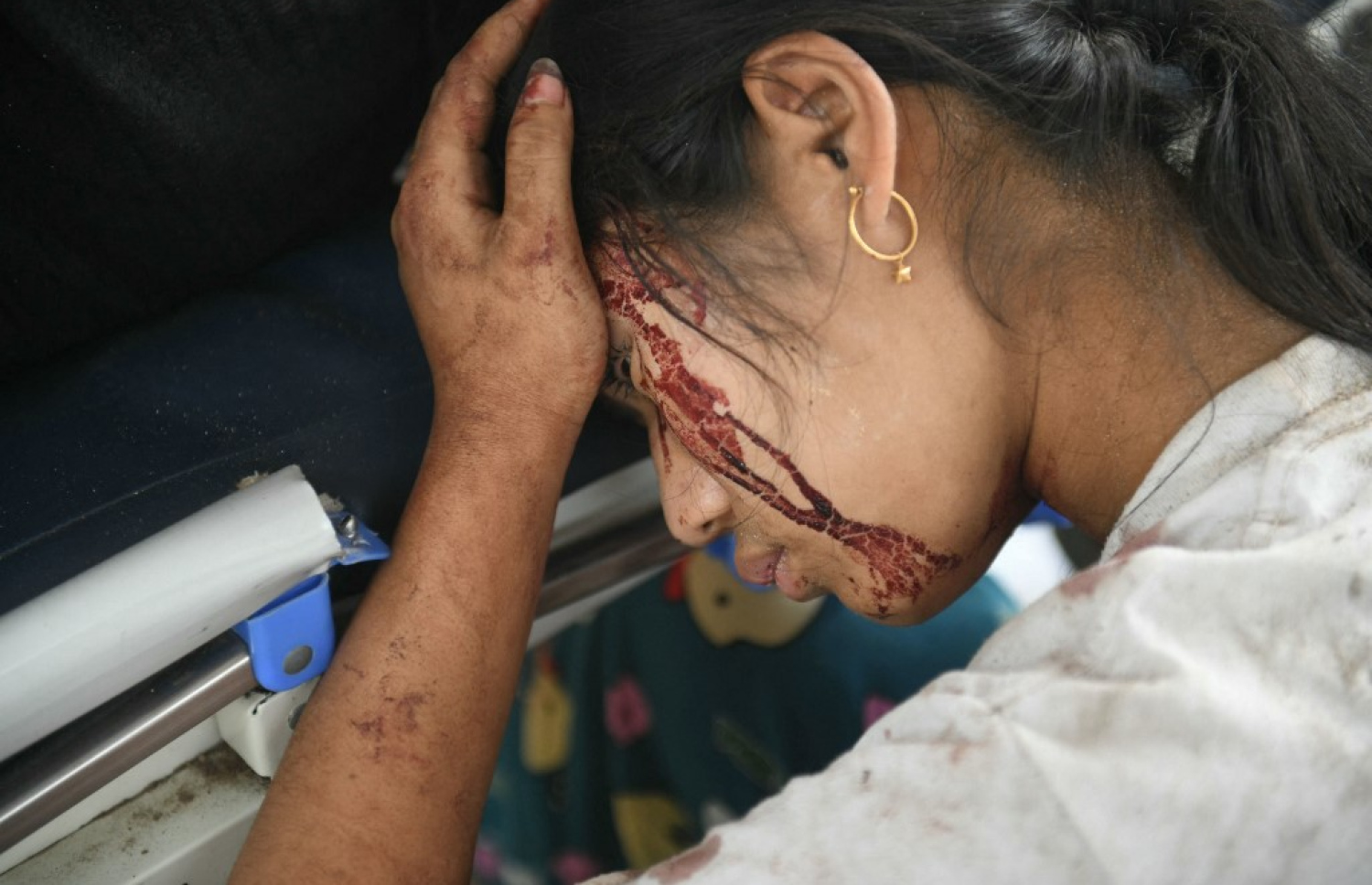 ބިންހެލުމުގެ ސަބަބުން މިއަންމާގައި އަނިޔާވި މީހެއްގެ ބޮލުން ލޭތައް ފައިބަނީ: ޒަހަމްވި މީހުން ގިނަވެ މިއަންމާގެ ހޮސްޕިޓަލްތަކަށް ވަނީ ބާރު ބޮޑުވެފައި. -- ފޮޓޯ: އޭއެފްޕީ