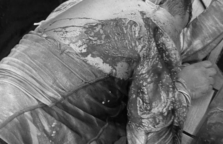 މިޔަރެއްގެ ހަމަލާގައި ކޮނޑުހުޅު ނެއްޓި ބޮޑު ޒަހަމެއް