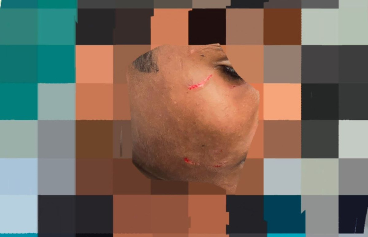 ދަރިވަރަކަށް ބުލީކޮށް އަނިޔާކުރި މައްސަލައެއް ބަލަނީ